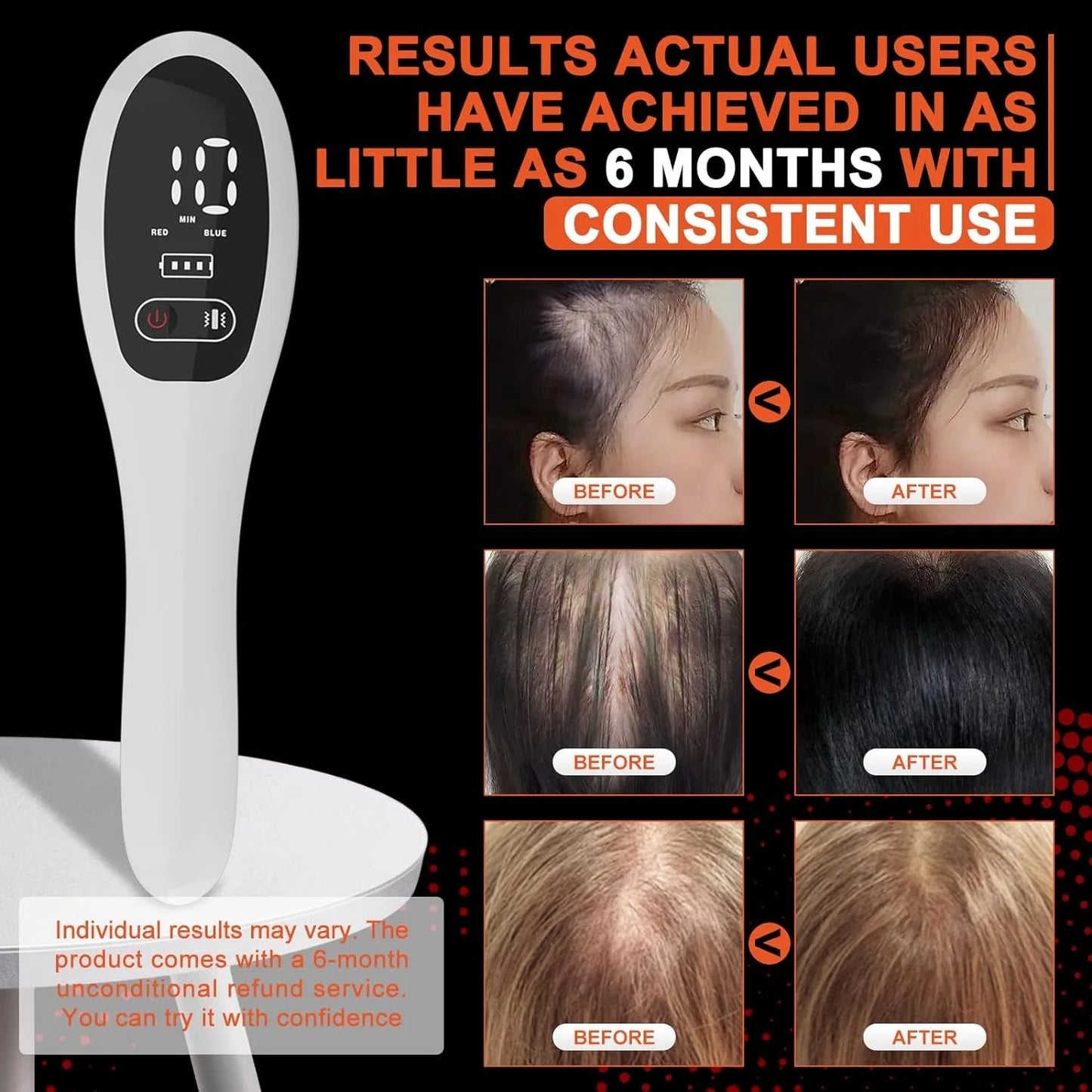 Laser Hair Growth Comb – Anti-Hair Loss Therapy